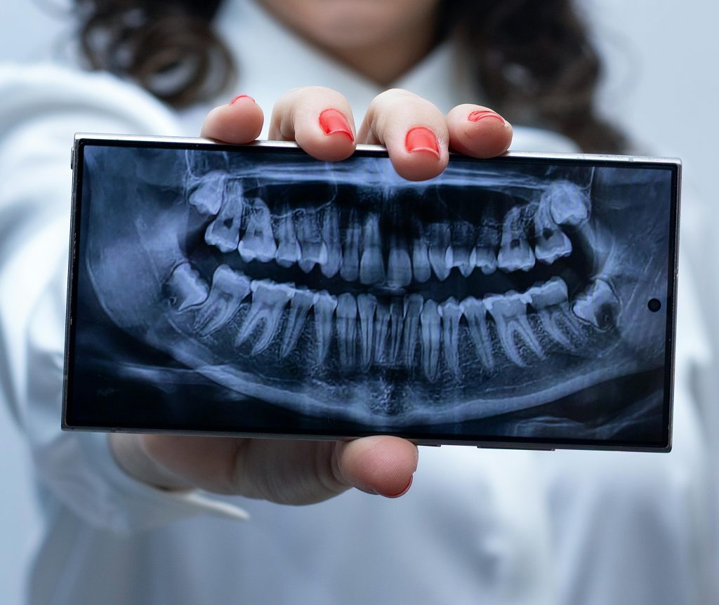 X-RAY
